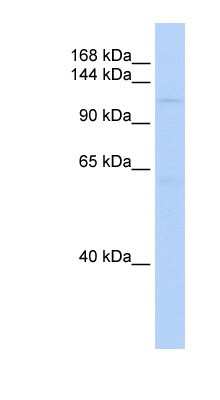 Western Blot: SIN3B Antibody [NBP1-79381]