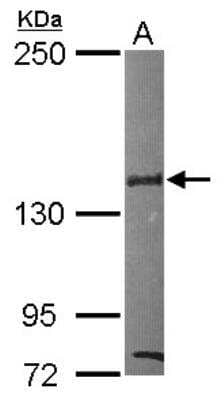 Western Blot: SIN3B Antibody [NBP2-20367]