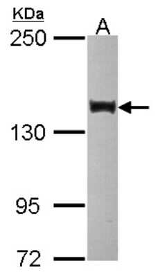 Western Blot: SIN3B Antibody [NBP2-20368]