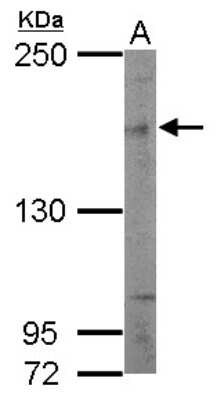 Western Blot: SIN3B Antibody [NBP2-20368]