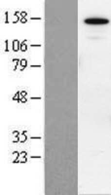 Western Blot: SIN3B Overexpression Lysate [NBP2-07193]