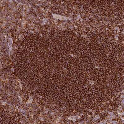 Immunohistochemistry-Paraffin: SIPA1 Antibody [NBP2-32620]