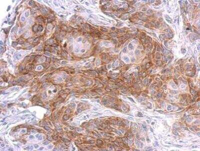 Immunohistochemistry-Paraffin: SIPA1 Antibody [NBP2-20369]