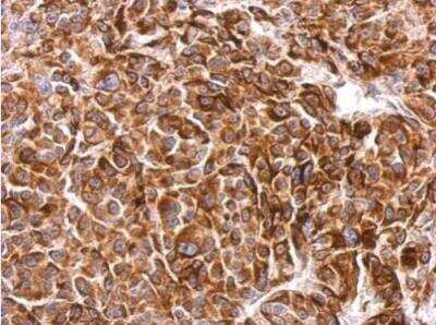 Immunohistochemistry-Paraffin: SIPA1 Antibody [NBP2-20369]