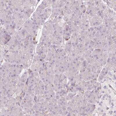 Immunohistochemistry-Paraffin: SIPA1 Antibody [NBP2-32620]