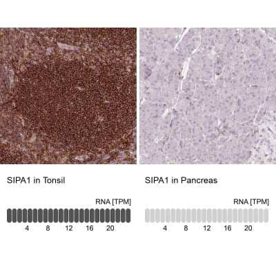 Immunohistochemistry-Paraffin: SIPA1 Antibody [NBP2-32620]