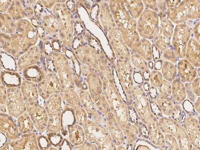Immunohistochemistry-Paraffin: SIPA1 Antibody [NBP2-98740]