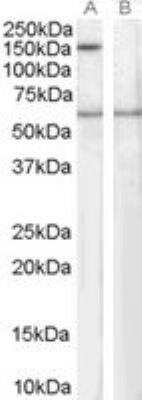 Western Blot: SIPA1 Antibody [NB100-1390]