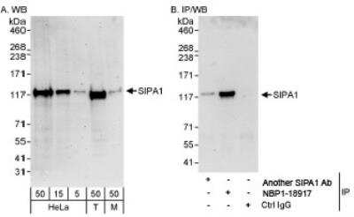 Western Blot: SIPA1 Antibody [NBP1-18917]