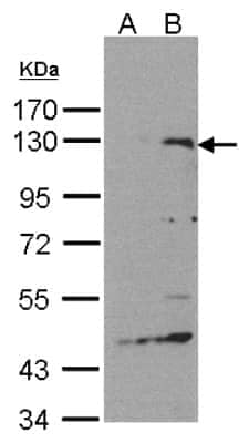 Western Blot: SIPA1 Antibody [NBP2-20369]