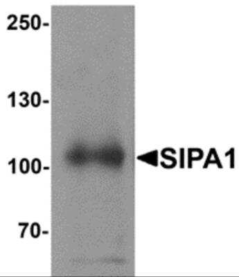 Western Blot: SIPA1 AntibodyBSA Free [NBP2-81850]