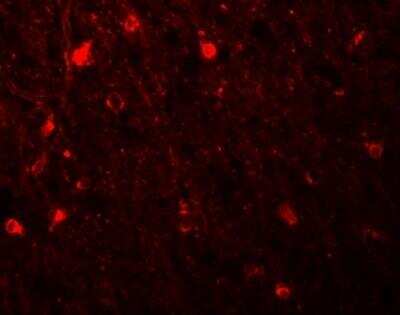 Immunocytochemistry/ Immunofluorescence: SIPA1L1 Antibody - BSA Free [NBP2-81801]