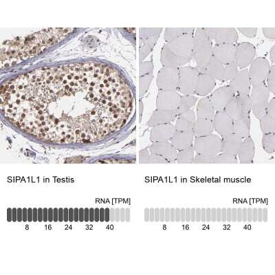 Immunohistochemistry-Paraffin: SIPA1L1 Antibody [NBP1-90482]