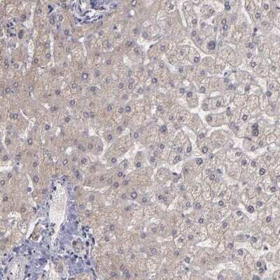 Immunohistochemistry-Paraffin: SIPA1L1 Antibody [NBP1-90482]