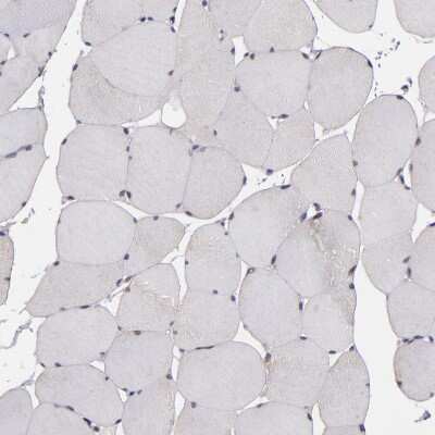 Immunohistochemistry-Paraffin: SIPA1L1 Antibody [NBP1-90482]