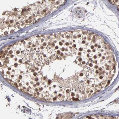 Immunohistochemistry-Paraffin: SIPA1L1 Antibody [NBP1-90482]