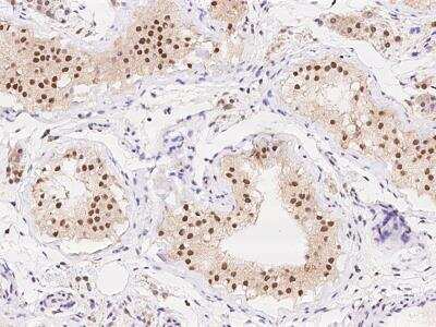 Immunohistochemistry-Paraffin: SIPA1L1 Antibody [NBP3-06158]