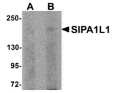 Western Blot: SIPA1L1 AntibodyBSA Free [NBP2-81801]