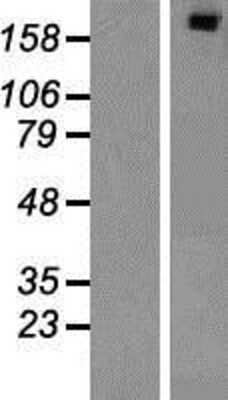 Western Blot: SIPA1L1 Overexpression Lysate [NBP2-07149]