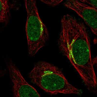 Immunocytochemistry/ Immunofluorescence: SIPA1L2 Antibody [NBP2-55576]