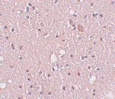 Immunohistochemistry-Paraffin: SIPA1L2 Antibody - BSA Free [NBP1-77090]