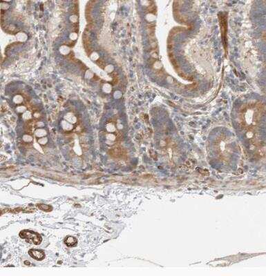 Immunohistochemistry-Paraffin: SIPA1L2 Antibody [NBP1-81412]