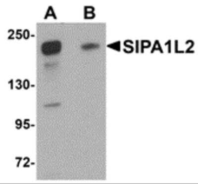 Western Blot: SIPA1L2 AntibodyBSA Free [NBP1-77090]