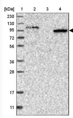 Western Blot: SIPA1L2 Antibody [NBP1-81412]