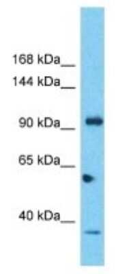 Western Blot: SIPA1L2 Antibody [NBP3-09888]