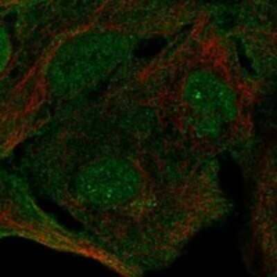 Immunocytochemistry/ Immunofluorescence: SIPA1L3 Antibody [NBP3-17768]