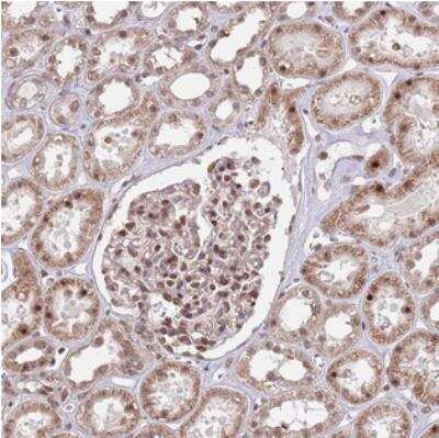 Immunohistochemistry: SIPA1L3 Antibody [NBP2-30563]
