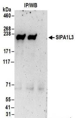 Immunoprecipitation: SIPA1L3 Antibody [NBP2-30363]