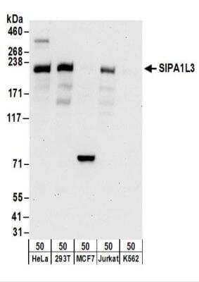 Western Blot: SIPA1L3 Antibody [NBP2-30362]