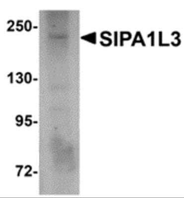 Western Blot: SIPA1L3 AntibodyBSA Free [NBP2-81902]