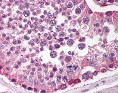 Immunohistochemistry-Paraffin: SIRP alpha/CD172a Antibody - BSA Free [NBP1-03074]