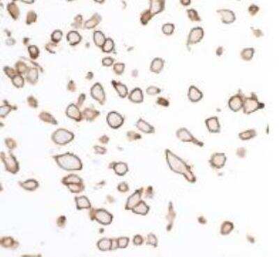 Immunocytochemistry/ Immunofluorescence: SIRP alpha/CD172a Antibody (BLR049F) [NBP3-14675]