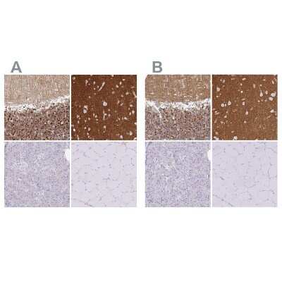 Immunohistochemistry-Paraffin: SIRP alpha/CD172a Antibody [NBP2-58429]