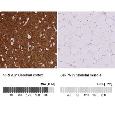 Immunohistochemistry-Paraffin: SIRP alpha/CD172a Antibody [NBP2-58429]