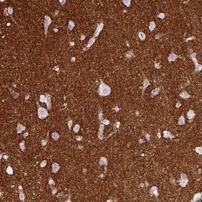 Immunohistochemistry-Paraffin: SIRP alpha/CD172a Antibody [NBP2-58429]