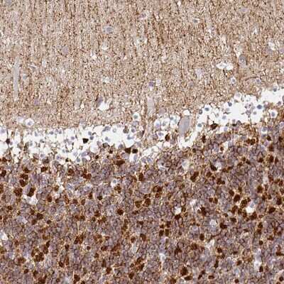 Immunohistochemistry-Paraffin: SIRP alpha/CD172a Antibody [NBP2-58429]