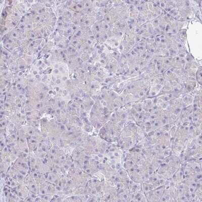 Immunohistochemistry-Paraffin: SIRP alpha/CD172a Antibody [NBP2-58429]