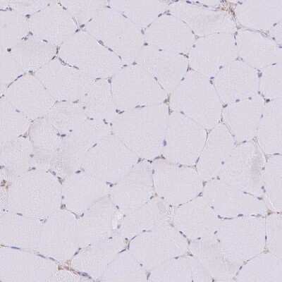 Immunohistochemistry-Paraffin: SIRP alpha/CD172a Antibody [NBP2-58429]
