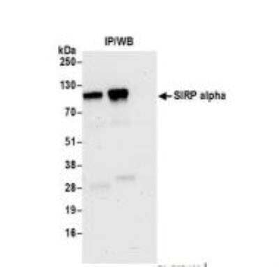 Immunoprecipitation: SIRP alpha/CD172a Antibody (BLR049F) [NBP3-14675]