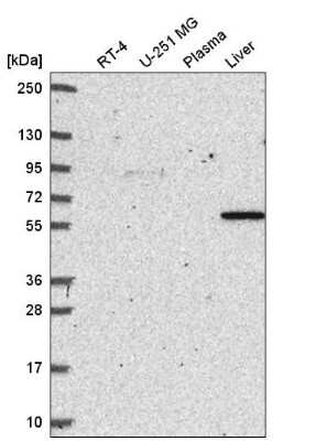 Western Blot: SIRP alpha/CD172a Antibody [NBP2-56723]