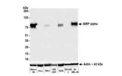 Western Blot: SIRP alpha/CD172a Antibody (BLR049F) [NBP3-14675]