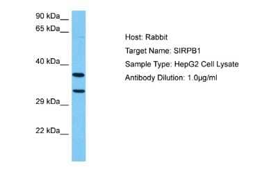 Western Blot: SIRP beta 1/CD172b Antibody [NBP2-83528]