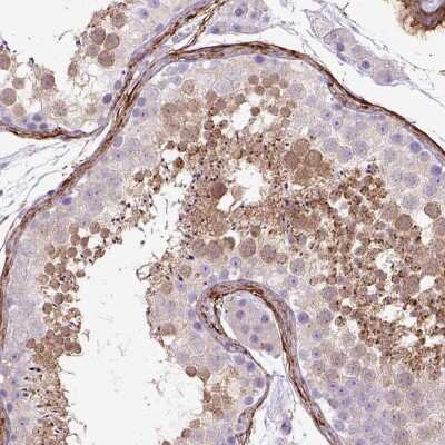 Immunohistochemistry-Paraffin: SIRP delta Antibody [NBP2-31924]