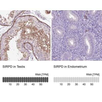 Immunohistochemistry-Paraffin: SIRP delta Antibody [NBP2-31924]