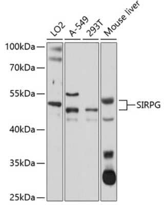 Western Blot: SIRP gamma/CD172g AntibodyBSA Free [NBP2-93281]