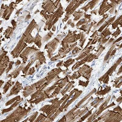 Immunohistochemistry-Paraffin: SIRP beta 1/CD172b Antibody [NBP2-13310]